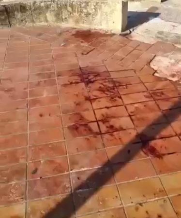 sangue4