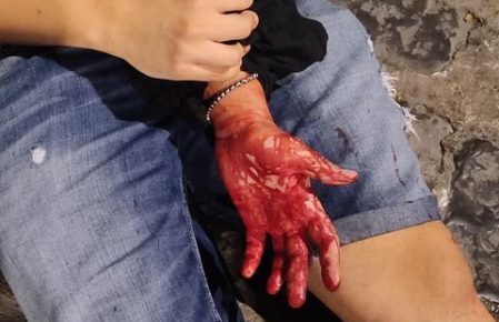 Napoli, in tre lo accoltellano al Centro Storico e gli rubano la cassa bluetooth 3 accoltellamento