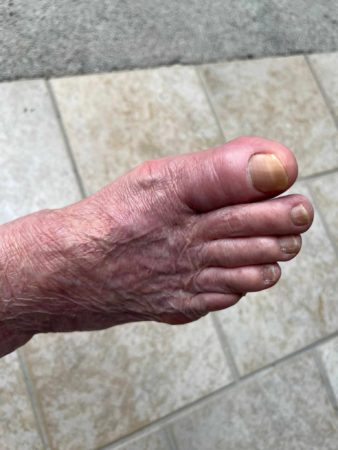 Marigliano, 85enne invalida presa a bastonate dalla badante. Borrelli: "E’ inaccettabile che quella donna lavori ancora presso altre persone anziane. Va fermata” 6 362493429 2000275173643063 6263495005224281437 n 1