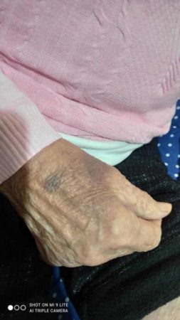 Marigliano, 85enne invalida presa a bastonate dalla badante. Borrelli: "E’ inaccettabile che quella donna lavori ancora presso altre persone anziane. Va fermata” 5 362886352 2061948517475277 3159738355833203750 n