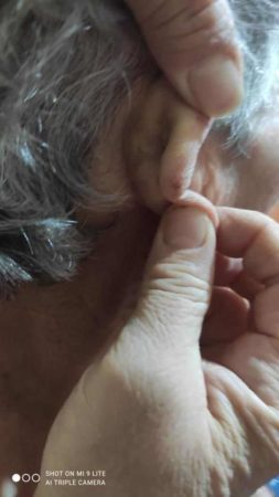 Marigliano, 85enne invalida presa a bastonate dalla badante. Borrelli: "E’ inaccettabile che quella donna lavori ancora presso altre persone anziane. Va fermata” 3 363081495 983665243088721 51807409936365205 n