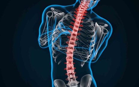 Napoli ospita il primo Meeting del Mediterraneo on Spinal Deformities: dall’impiego dell’intelligenza artificiale alle tecniche più innovative 3 Riabilitazione della colonna vertebrale nubramedica