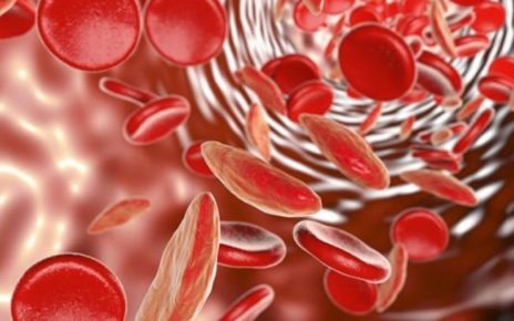 Salute, Talassemia: la frequenza di trasfusioni condiziona la vita dei pazienti 4 talassemia