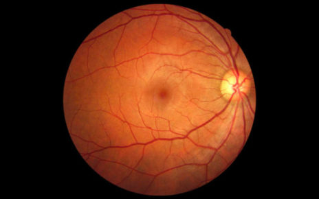 Retina, nuove cure: a Napoli i massimi esperti al mondo 5 retina