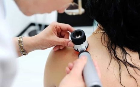 screeningmelanoma1