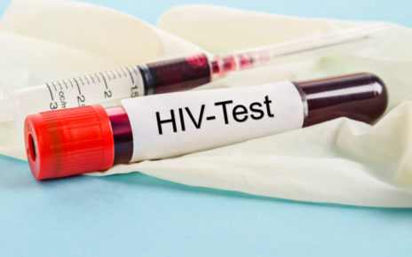 hiv