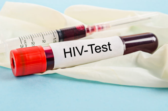 hiv