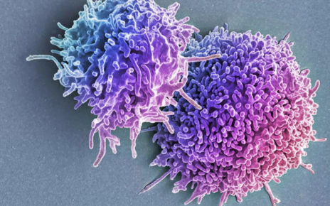 T lymphocytes ok