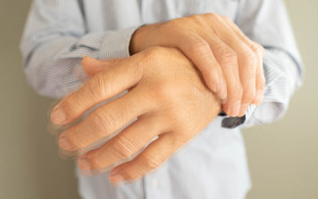 Parkinson, in 60 giorni via ai trattamenti per cancellare il tremore. All’A.O.U. Luigi Vanvitelli una nuova tecnologia cambierà la vita di migliaia di pazienti 3 Come si manifesta il morbo di Parkinson