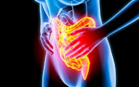 Colite ulcerosa, nuovo farmaco migliora qualità della vita 3 colite ulcerosa tutto quello che ce da sapere