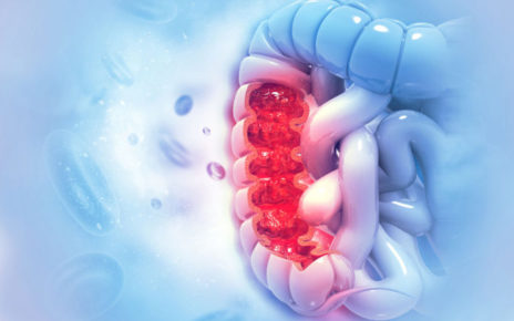 Napoli, Tumore del colon. Francesco Selvaggi (Università Vanvitelli): "Vi spiego cos’è e come si tratta il tumore che ha colpito Totò Schillaci" 3 default ca colon retto