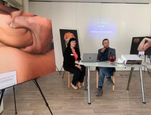 Napoli, successo per la Mostra fotografica "Corpi Scomodi" 2 corpi2