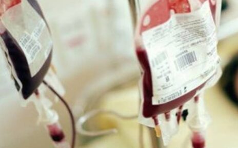 Napoli, Emergenza sangue: 500 donatori in venti giorni non sono bastati a garantire le scorte. Al Cardarelli vi è carenza di sangue gruppo 0 10 emergenzasangue