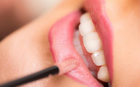 Impianto Dentale o Ponte: Qual è la Scelta Migliore per i Tuoi Denti? 6 lipstick 1942172 640