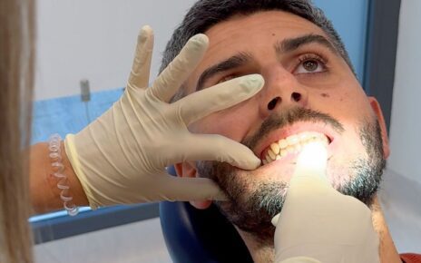 Faccette dentali a Lucca: guida completa all’estetica del sorriso 3 SFONDO 4 news Dentista a Lucca
