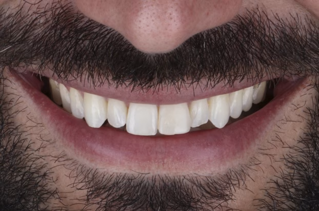 Sorriso