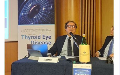 Malattia oculare tiroidea, in Campania 5 mila pazienti in cerca di cure 5 strianese