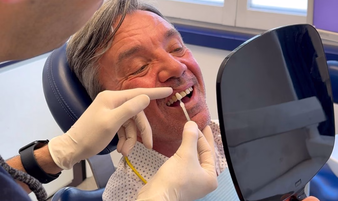 1. Faccette dentali a Firenze Ippocrate