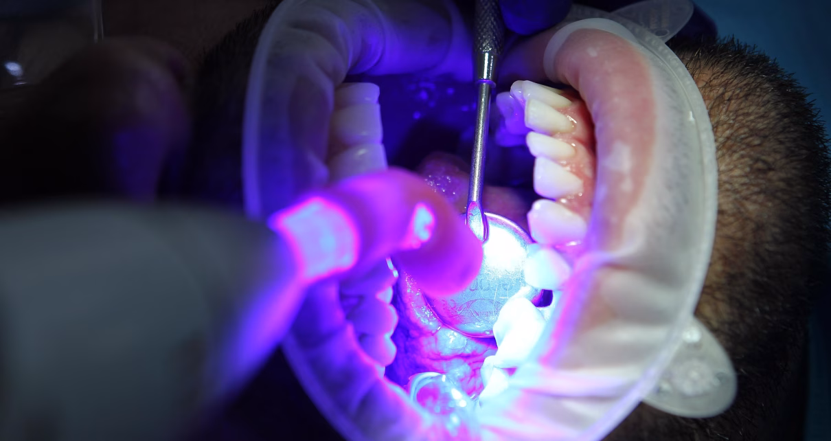 diegotoralabad dentist 7397734 1920