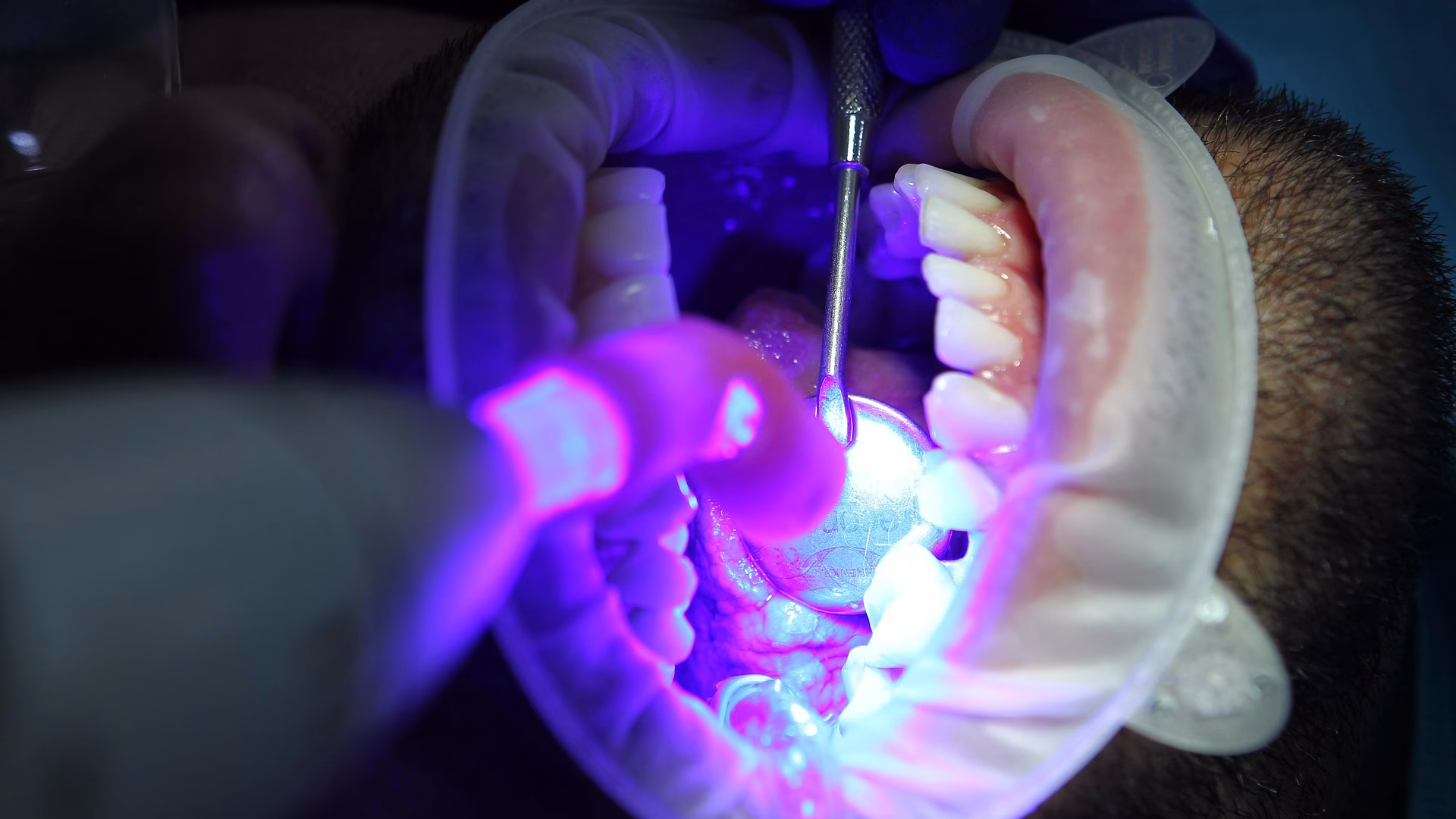 diegotoralabad dentist 7397734 1920