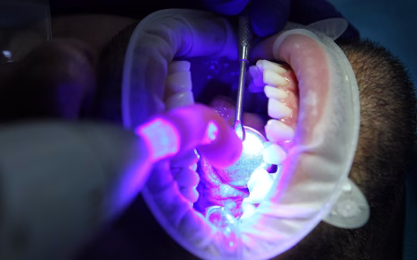 Come ottenere denti bianchi e luminosi: le soluzioni migliori 4 diegotoralabad dentist 7397734 1920