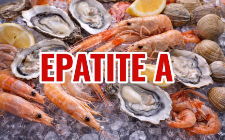 Epatite A, Napoli corre ai ripari: stop ai frutti di mare crudi nei locali 5 654808418 946436801111618 6159612855683264155 n
