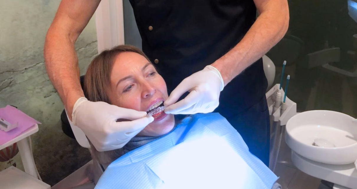 ORTODONZIA TRASPARENTE a Montebelluna