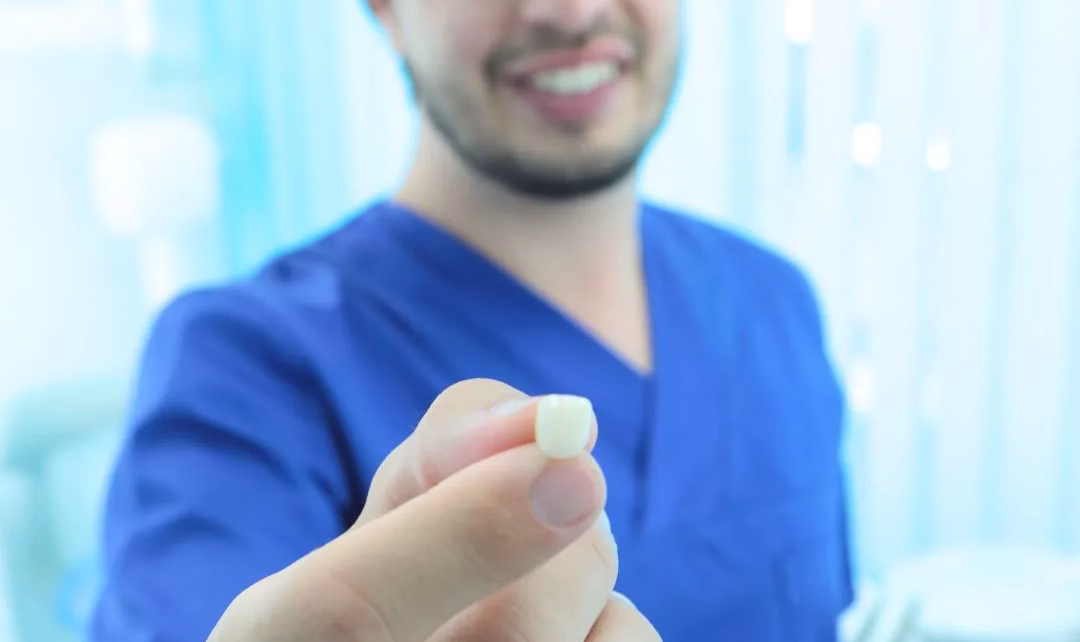 1. FACCETTE DENTALI a Milano Dergano Dottor Fiocchi Clinica Odontoiatrica