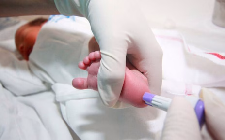 Giornata mondiale dello Screening Neonatale: SIMMESN richiama l'attenzione su diagnosi precoce, equità e presa in carico 4 test screening neonatale 787x524 c